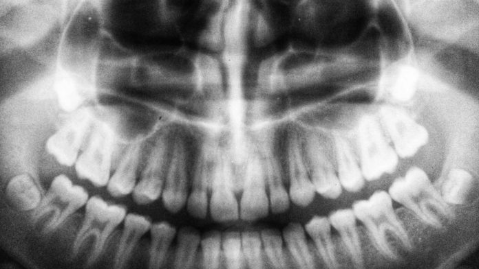 know-the-basics-of-ct-scan-home-talk