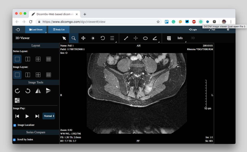 online DICOM reader