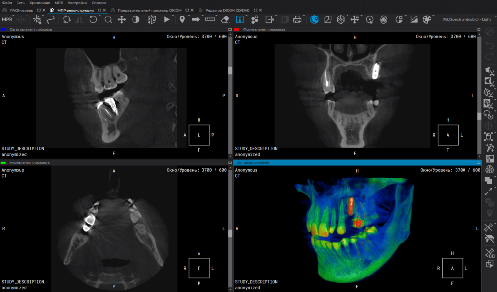 online DICOM reader